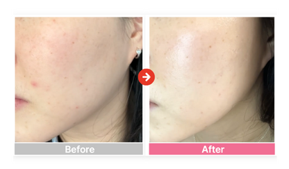 Peache Rose Leaf Clay Pack Cleanser